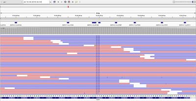 Case Report: Dacomitinib is effective in lung adenocarcinoma with rare EGFR mutation L747P and brain metastases